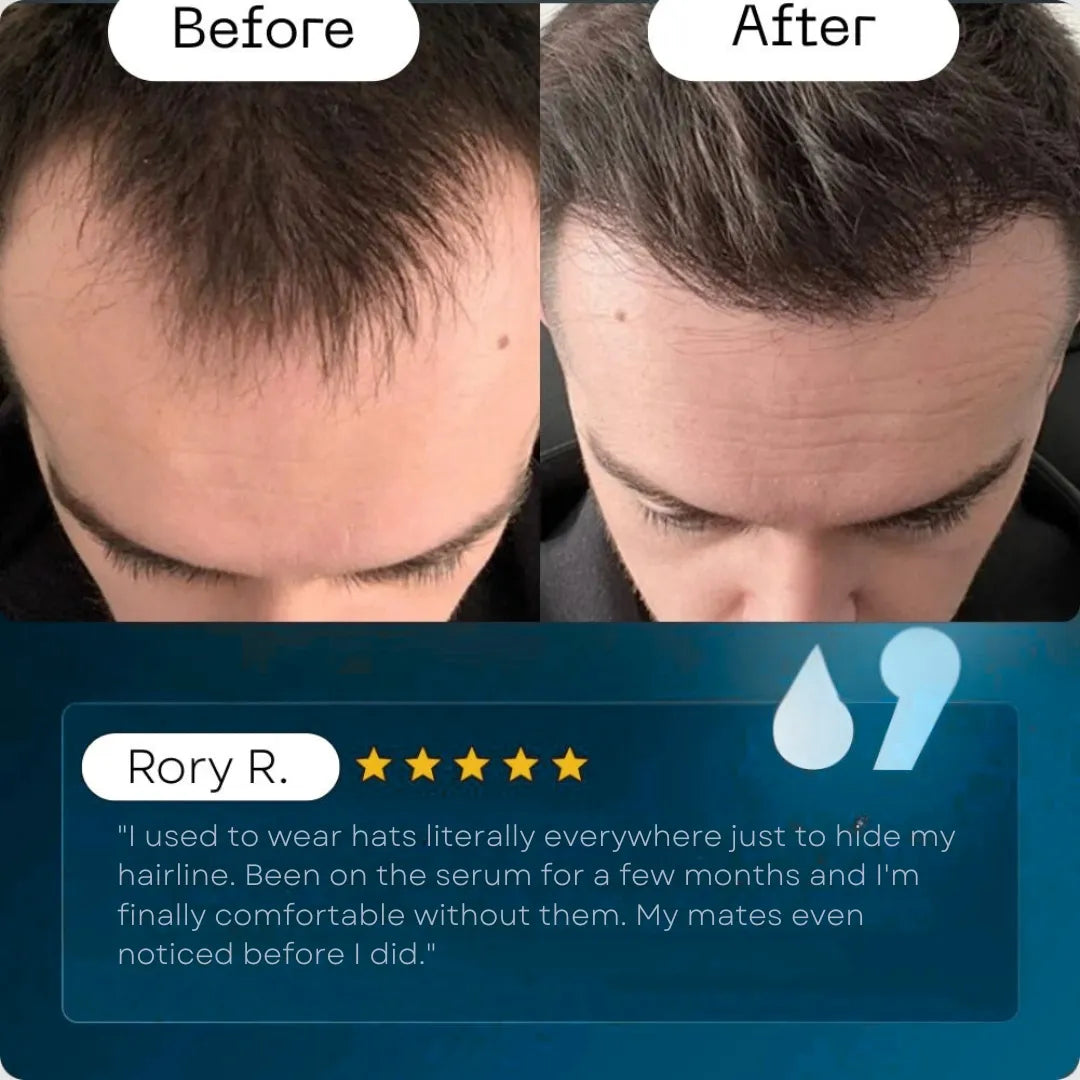 Men's Regrowth Activator Serum