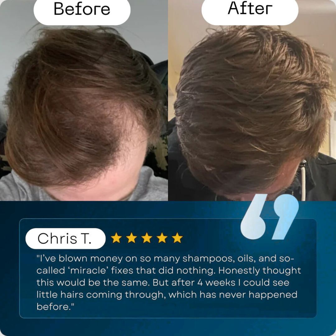 Men's Regrowth Activator Serum