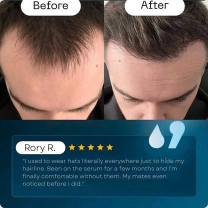 Men's Regrowth Activator Serum